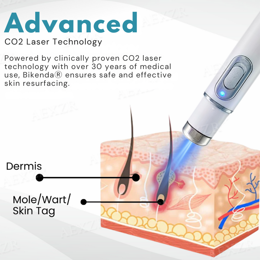 Bkenda® Non-Invasive Mole and Wart Removal Laser Pen