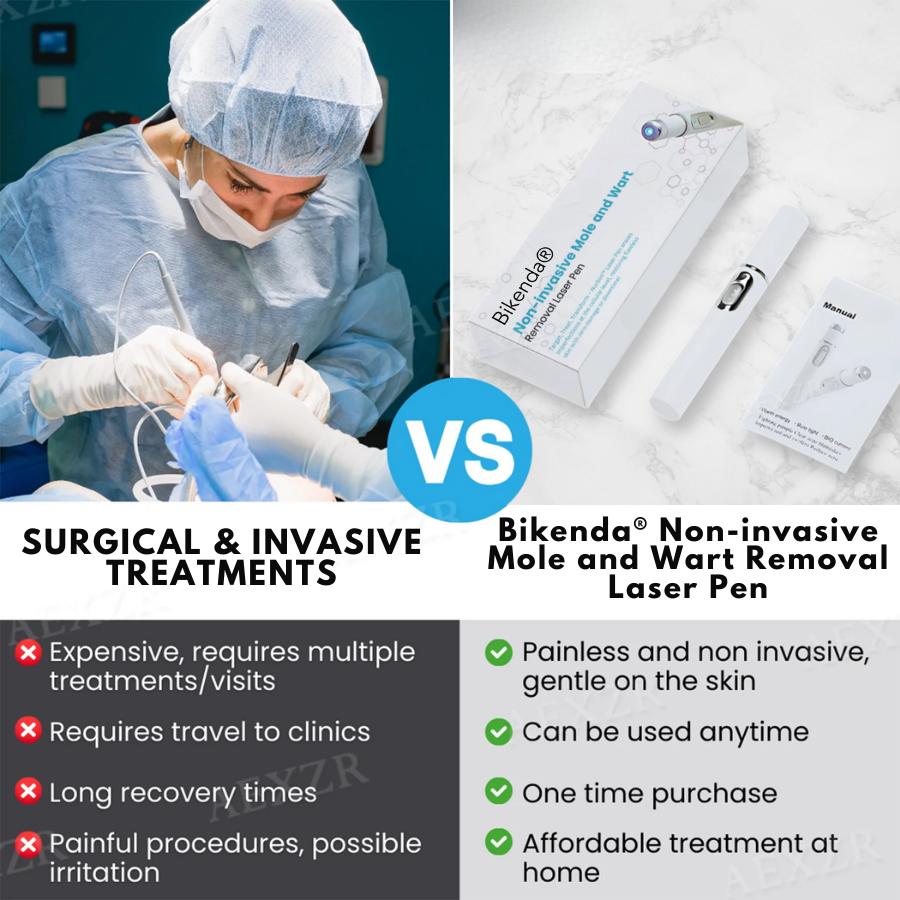 Bkenda® Non-Invasive Mole and Wart Removal Laser Pen