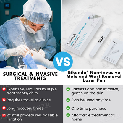 Bkenda® Non-Invasive Mole and Wart Removal Laser Pen